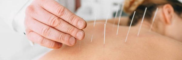 Acupuncturist inserting a needle into a female back. patient having traditional Chinese treatment using needles to restore an energy flow through specific points on the skin.